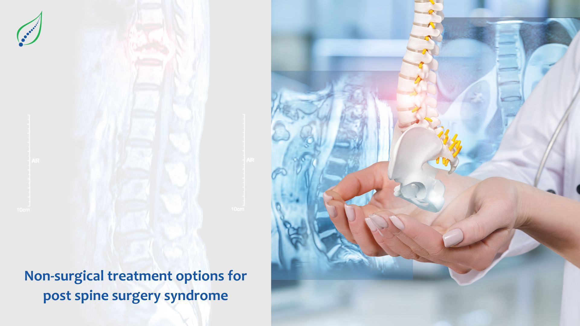 Non-Surgical Treatment Options For Post Spine Surgery Syndrome